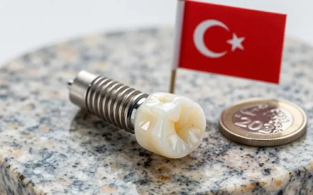 Slik blir tannimplantater prisen i Tyrkia 2026 – komplett guide